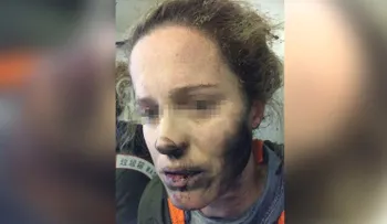 Auriculares de una pasajera se incendian en pleno vuelo