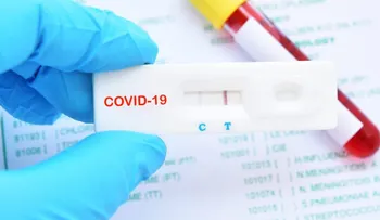 EEUU autoriza por 1ra vez un test de anticuerpos de coronavirus que se hace en casa