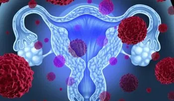Una menstruación irregular aumenta el riesgo de cáncer de ovario