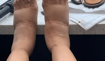 Cardi B y sus pies hinchados de los que todos hablan