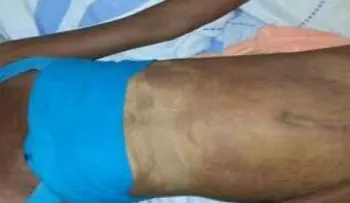 Identifican como Yarisa Adon (La flaca), mujer encontrada muerta en hotel de Villa Francisca 