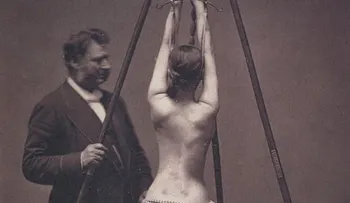 Imágenes chocantes y aterradoras...17 terribles secretos de la medicina del pasado
