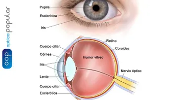 La uveítis; (inflamación en capa media del ojo), puede provocar la pérdida permanente de la visión