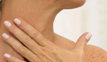 5 remedios que no fallan para eliminar las arrugas del cuello