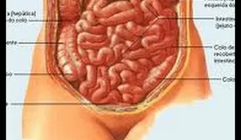 Remedio para el estrenÌ?imiento y la colitis: Inflamación del intestino y colon irritable (Video)