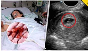 Ella perdió a su bebé en un aborto y Dios le dio esta lección (VIDEO)