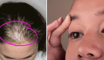 Este aceite es genial para el engrosamiento del cabello, pestañas y cejas