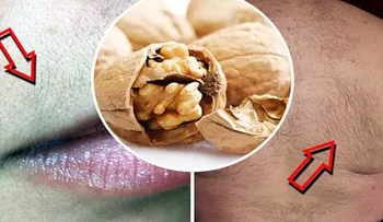 Elimina el vello de la cara y el cuerpo con esta sencilla receta