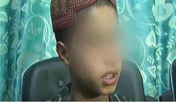 Cuenta su historia: Vendido por sus padres en 10 mil USD y logró escapar de una muerte segura