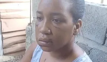 Mujer relata cómo sobrevivió a 26 puñaladas de su expareja en La Vega
