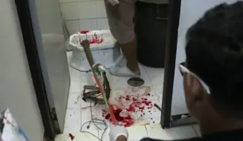 Una pitón escondida en un baño le muerde el pene a un hombre