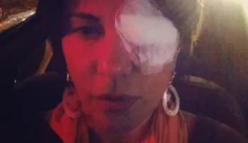 Operan de un ojo a Milagros Germán