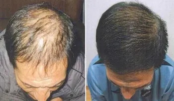 Este producto hará que tu pelo empiece a crecer como loco en una semana
