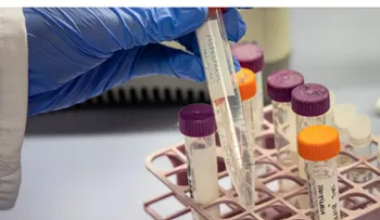 Desarrollan terapia génica para prevenir el alzhéimer