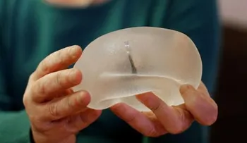 Los implantes de senos: "Por ahorrarnos tres pesos, nos arriesgamos a una complicación"