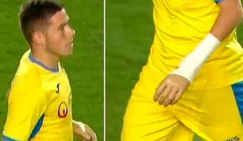 Un accidente de tránsito le quitó una mano, pero 9 años después debutó como futbolista