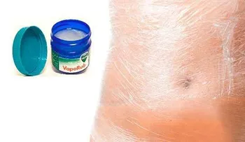 Vicks Vaporub para reducir rápidamente el abdomen