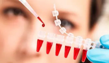 Desarrollan un revolucionario análisis de sangre que localiza un cáncer sin cirugías invasivas