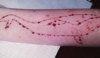 Los tentáculos del aterrador reto de la 'ballena azul' llegan a Brasil