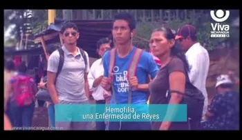 La hemofilia, una enfermedad incurable