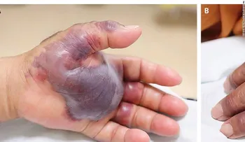 Piensa dos veces antes de comer pescado crudo... esta es la razón