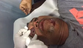 Fotógrafos rechazan "intenciones" de la PN de acusar a Danny Polanco