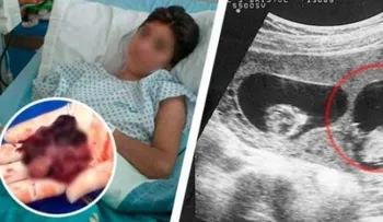 Ella decidió no tener a su hijo y DIOS le dio una lección que jamás olvidará