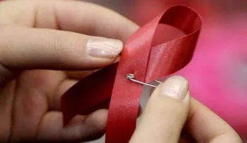El Sida llegó a EU desde África a través de Haití, según estudio 