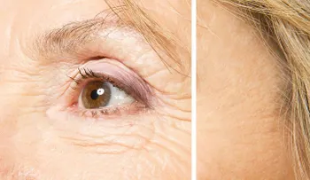 Cómo lucir más joven y con menos arrugas con remedios naturales