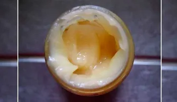 Lo tiene en la casa: 4 productos para hacer una crema antiarrugas 