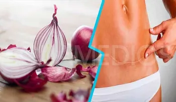 Cebolla para eliminar cicatrices y estrías: ¡No gaste más dinero en Láser!
