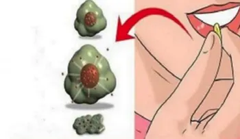 El cáncer muere cuando se comen estos 7 alimentos, es hora de empezar a comerlos!!