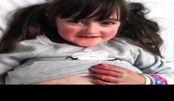 Una niña tiene alas de mariposa por una extraña enfermedad (VIDEO)