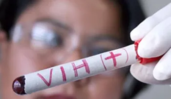  El VIH-sida se alimenta de la crisis venezolana 