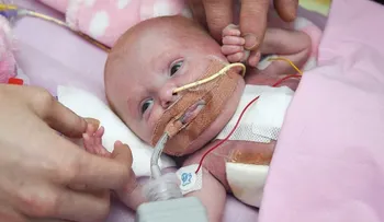 Esta bebé nació con el corazón por fuera de su cuerpo: así sobrevivió