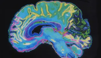 Cinco claves para mantener un cerebro activo toda la vida