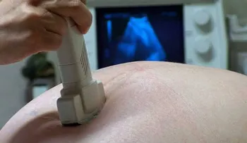 Practican cesárea a doctora padeció Guillian Barré