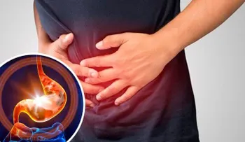La dieta para la gastritis: qué alimentos comer y cuáles evitar