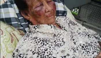 Delincuentes asaltan y golpean anciana de 90 años 