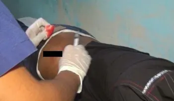 Hieren recluso por deuda de 15 pesos