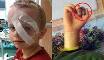 Niña de 8 años muere al resbalarse mientras jugaba
