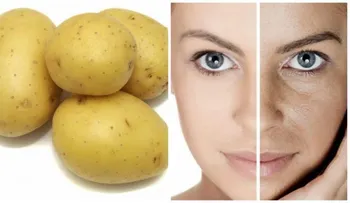 Las manchas: eliminala en 3 noches con este simple remedio