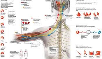 Fibromialgia, cuando el dolor es real
