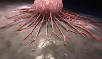 Un médico británico mata de forma simple el cáncer en sus últimos días .. !!!