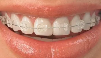Algunas alternativas ante una ortodoncia incorrecta