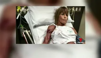 Australiana es atacada brutalmente por un canguro
