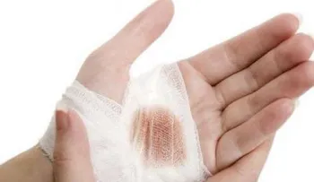 12 datos curiosos sobre las heridas
