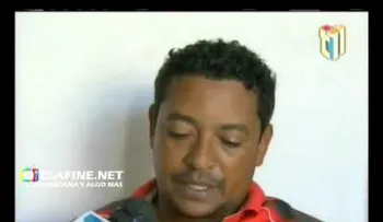 Mira cómo quedó este dominicano cuando su celular explotó  (VIDEO)