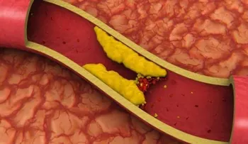4 cucharadas de esto y adiós a la presión arterial y arterias obstruidas