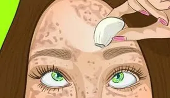 El remedio para la piel perfecta que borra las manchas como una goma (en hombres y mujeres)